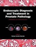 Endoscopic Diagnosis And Treatment In Prostate Pathology - Handbook Of Endourology Hardcover