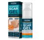 Scar Removal Gel