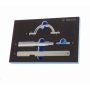 Timing & Locking Kit Opel