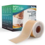 Professional Silicone Scar Sheets 1.6" X 150" Scar ROLL-3.8M - Scars Removal Treatment - Reusable Silicone Scar Tape Strips Type