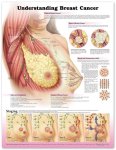 Understanding Breast Cancer 9758