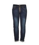 Circle Button Skinny Jeans - Denim Blue XL