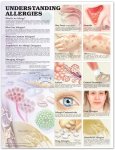 Understanding Allergies Anatomical Chart 9864