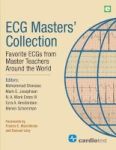 Ecg Masters& 39 Collection - Favorite Ecgs From Master Teachers Around The World Paperback