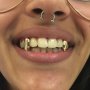 Hip-hop Style Copper Single Fake Tooth Grillz With Tool - Perfect For Daily Wear & Parties