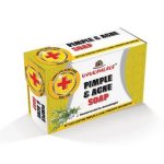 Uvukahlale Soap Pimple acne