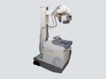Root Canal Front Tooth Xray