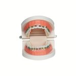 Tooth Orthodontics Models Orthodontics Tooth Molds Metal Ceramic Contrast Brackets Wire Display Models