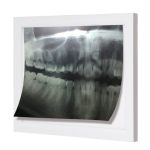 0.5 In Thick X-ray Viewer X-ray Viewer LED Wall Mounting 5W Dc 12V No Shadows For Clinic Hospital