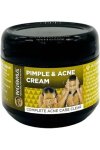 Ngoma Pimple & Ance Crm