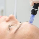 Purl S Derma Solution Online Course Microneedling