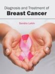 Diagnosis And Treatment Of Breast Cancer Hardcover