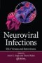 Neuroviral Infections - Rna Viruses And Retroviruses   Paperback