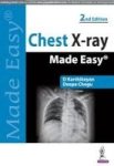 Chest X-ray Made Easy Paperback 2ND Revised Edition