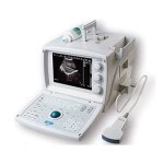 Ultrasound Black White Basic Portable 9.7 Lcd Monitor 1 Convex Probe Battery