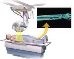 X Ray Cbct