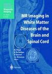 Mr Imaging in White Matter Diseases of the Brain and Spinal Cord