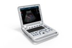 CMS600P2PLUS B Ultrasound Portable With Abdomen Convex Probe