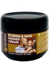 Ngoma Eczema & Skin Rash Crm