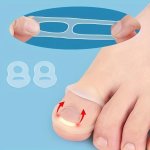 1PC Ingrown Toenail Ring Stretch-resistant And Reusable Toe Sleeve For Ingrown Toenails