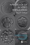 Handbook Of In Vitro Fertilization Paperback 4TH Revised Edition