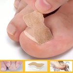 50PCS Ingrown Toenail Correction Strips - Glue-free Odorless Nail Care Pads For Foot & Hand