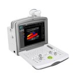 FDC6000 Full-color Doppler Ultrasound System