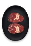 Beef Shin - + -1KG