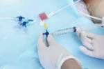 Blue Cannula
