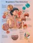 Respiratory Tract Infections Chart VR1253