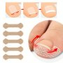 10PCS Ingrown Toenail Correction Stickers - Paronychia Treatment & Recovery Patches Odorless Pedicure Tools