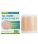 Silicone Scar Patches - Professional Scar Removal Roll - 4X150CM