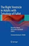 The Right Ventricle In Adults With Tetralogy Of Fallot