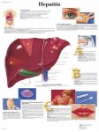Hepatitis Chart VR1435