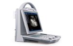 KX5600 Human Diagnostic Ultrasound