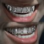 2 Pcs Hip Hop Teeth Grillz: Flashy Gothic Punk Dental Ornaments For Parties Raves And Cosplay - December Birthstone 18K Gold Plated Copper Body