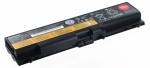 Lenovo Vibrant Battery For Thinkpad T430 T530 L430 P n: 0A36302 45N1001 45N1003 45N1005 45N1104 45N1105