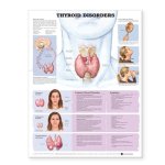 Thyroid Disorders Anatomical Chart 831X