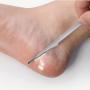 Professional Stainless Steel Foot File - Lightweight Callus Remover & Dead Skin Scraper For Men
