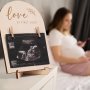 Unique Wooden Ultrasound Photo Frame With Double-sided Sign & Ink Pad - Perfect Pregnancy Announcement Gift For New Parents Decorative Room Accessory Cherished Memories Display