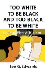 Too White To Be Black And Too Black To Be White: Living With Albinism